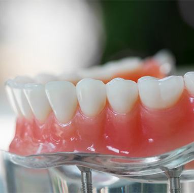 A close up of a good-looking set of dentures