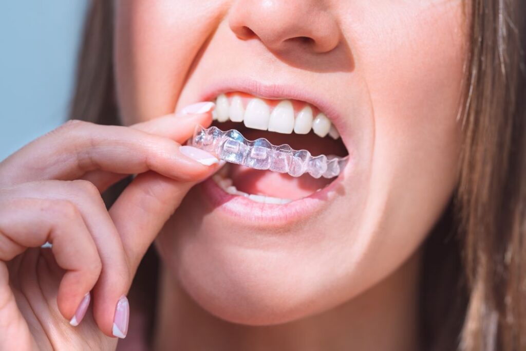 A woman putting on an Invisalign aligner